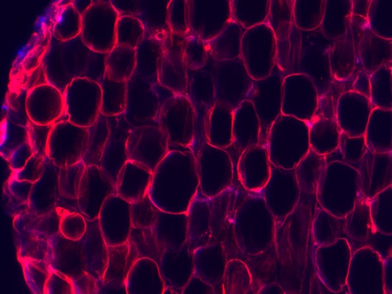 3D EYELIDSkin3D ADIPOPrint