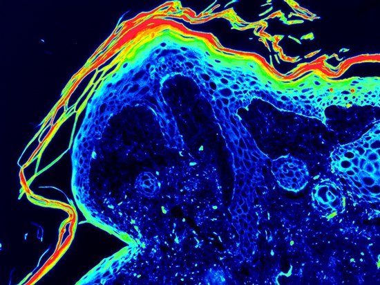 3D EYELIDSkin3D ADIPOPrint