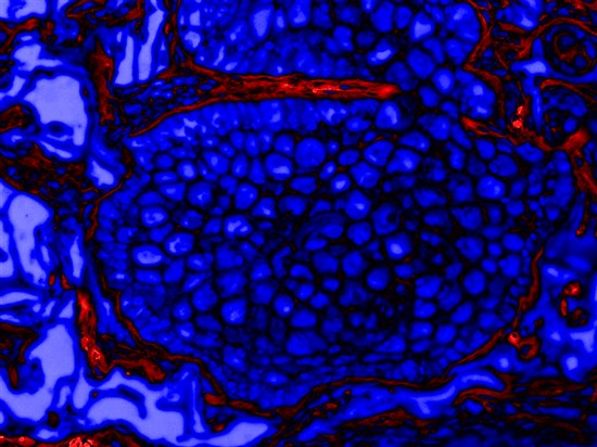 3D EYELIDSkin3D ADIPOPrint