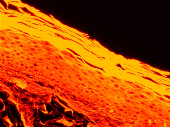 BLOC-PRINT3D WOUND HEALING