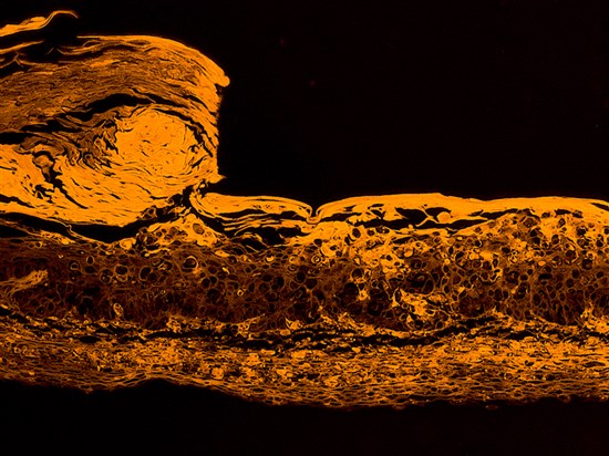 BLOC-PRINT3D WOUND HEALING