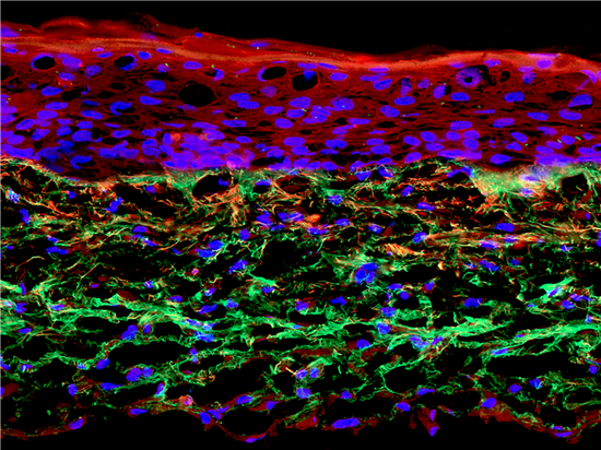 3D EYELIDSkin3D ADIPOPrint