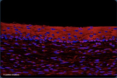 6. MDA_UV exposed