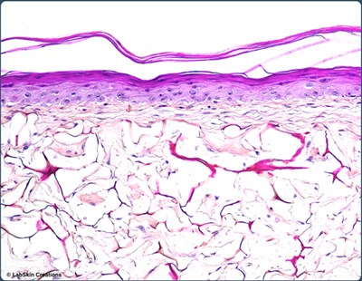 HPS_Glyc 2