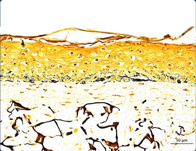 WS_Glyc 17
