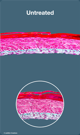 eyelids 1.png