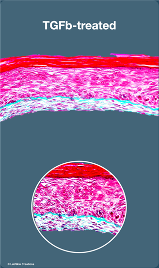 eyelids 2.png