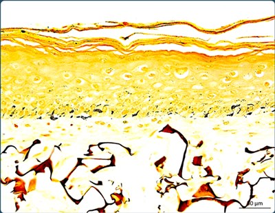 glycated 16
